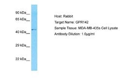 GPR142 Rabbit anti-Human, Polyclonal, Novus Biologicals 0.1ml; Unconjugated:Antibodies,